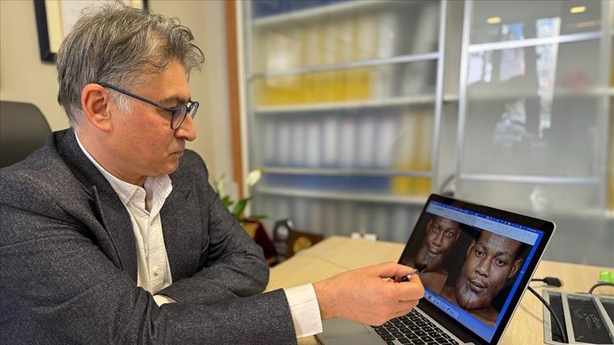 Gabonese patient finds solution to giant jaw tumor in Türkiye