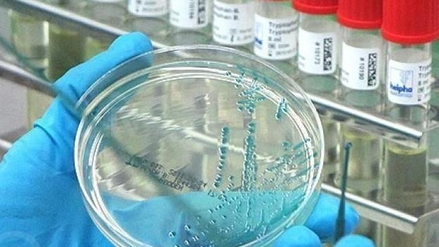 Bird flu detected in mainland Antarctica for 1st time