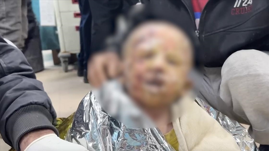 İsrail ordusu, minik bedeninde derin yanıklar açtığı 4 yaşındaki Seca’yı hastanede de rahat bırakmadı