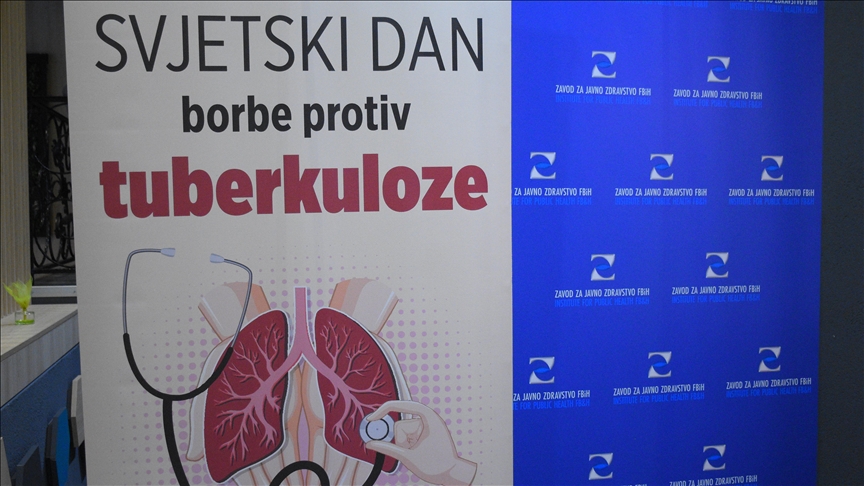 Svjetski dan borbe protiv tuberkuloze: Prošle godine u Federaciji BiH oboljele 232 osobe, umrlo osam