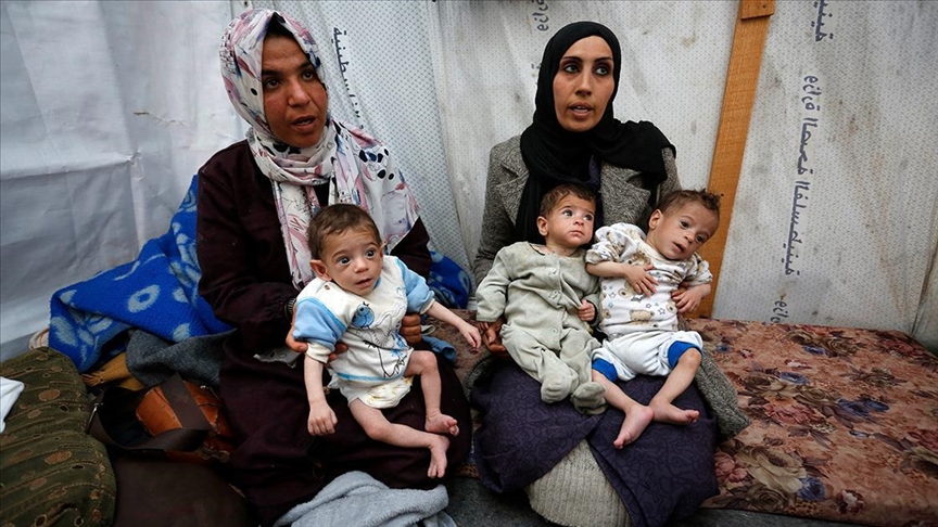 نگرانی مادر فلسطینی از سوء‌تغذیه فرزندان سه‌قلوی خود