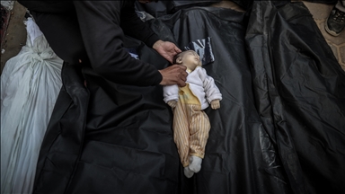 وفاة جديدة لطفل ترفع ضحايا الجوع في غزة إلى 30