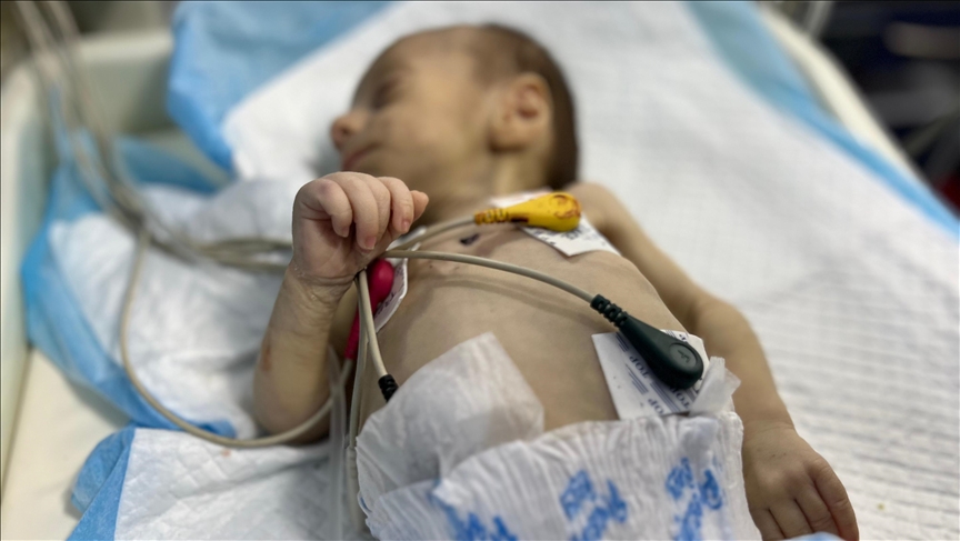 Газа: Бебето Лејла во канџите на смртта поради неисхранетост