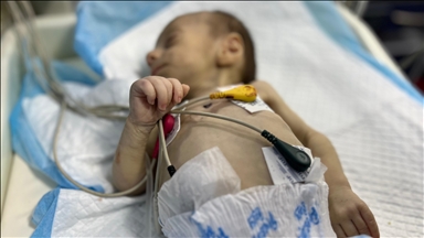 Газа: Бебето Лејла во канџите на смртта поради неисхранетост