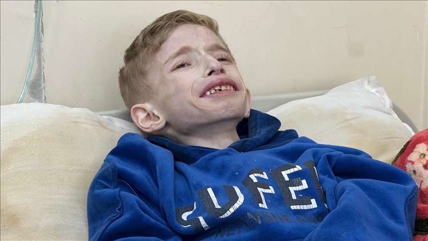 فادي الزنط.. طفل من غزة يتماثل للشفاء في مستشفى بمصر