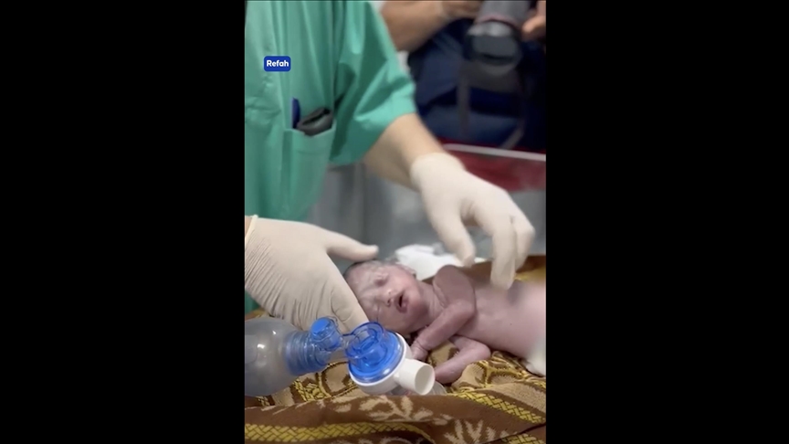 İsrail askerlerince öldürülen Filistinli hamile kadının bebeğini Gazzeli doktorlar kurtardı