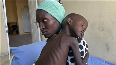 BM: Nijerya'da 5,9 milyon çocuk gıda ve yetersiz beslenme kriziyle karşı karşıya