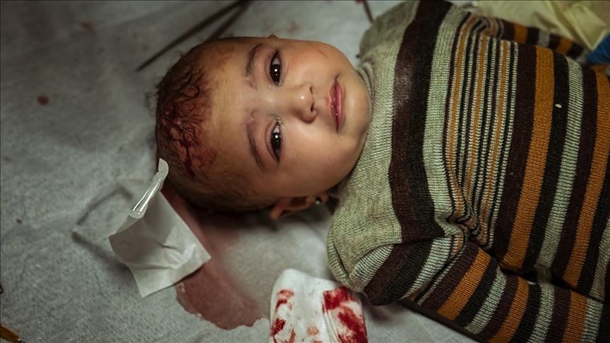 نوعية إصابات القصف الإسرائيلي بغزة “لم نصادفها من قبل”