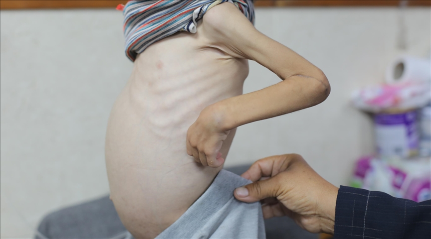Unicef denuncia que nueve de cada 10 niños en Gaza sufren pobreza alimentaria grave