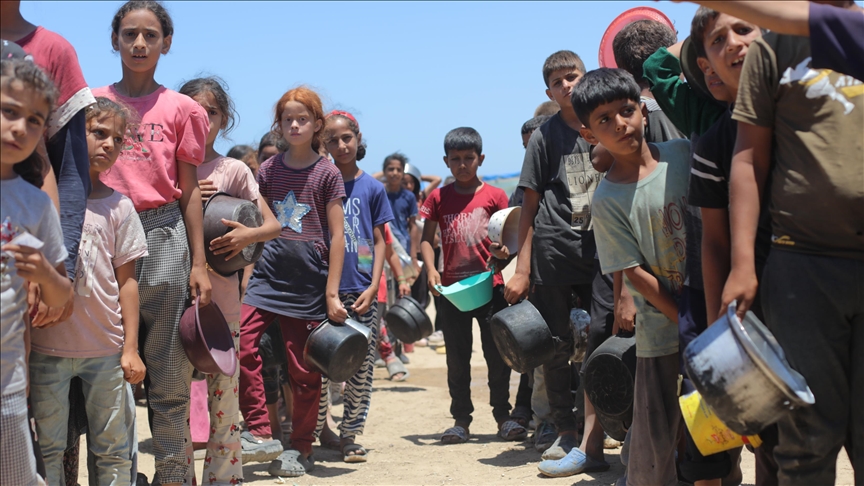 Gaza hospital records 50 malnourished Palestinian children in just a week