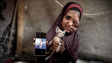 Filistinli kanser hastası kız çocuğu, tüm sağlık imkanlarından yoksun çadırda yaşam mücadelesi veriyor