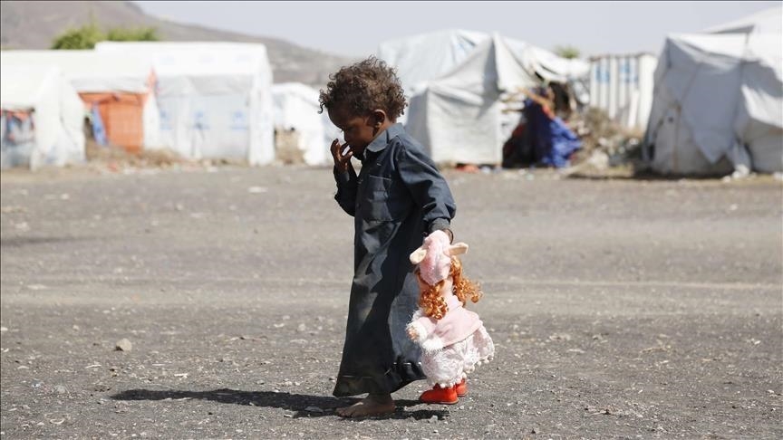 50% of Yemeni children suffer from chronic malnutrition: Prime minister