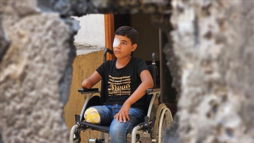 وحيد الغلبان.. طفل غزي غلبته الشظايا وغالب الإصابة بالأمل (تقرير)