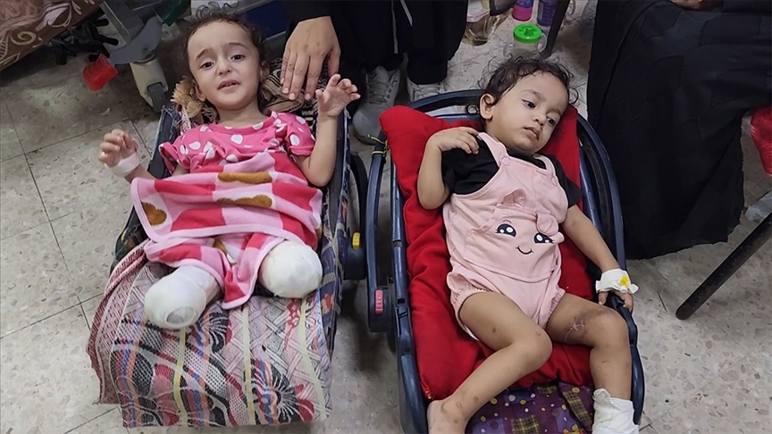 Gazze'de uzuvlarını kaybeden Filistinliler, rehabilitasyon ve psikolojik destekten de mahrum
