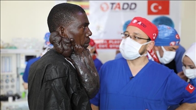 Turkish doctors remove 5-kilogram keloid mass from Ugandan patient