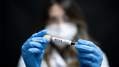 Germany detects 1st case of new mpox variant