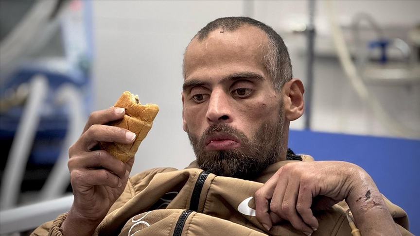 Salıverilen Filistinli, İsrail cezaevlerindeki işkenceden konuşma ve hareket yetisini büyük ölçüde kaybetti