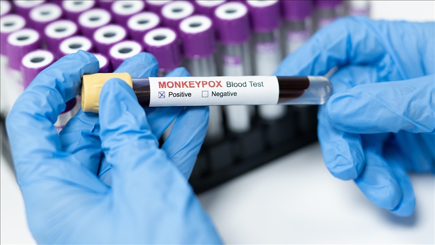 Philippines confirms 1 death from mpox, another in hospital