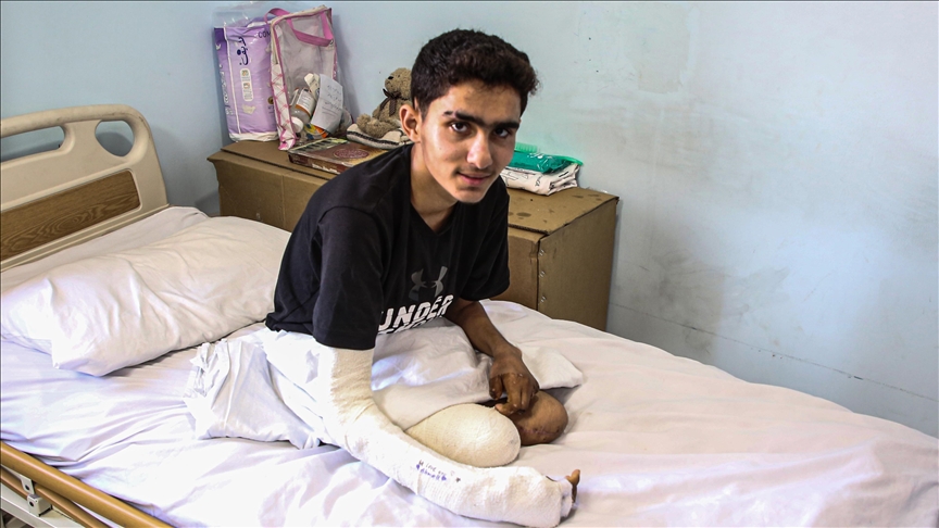 Palestinezi Ahmet që humbi këmbët në sulmin izraelit, ëndërron t'i kthehet gjimnastikës