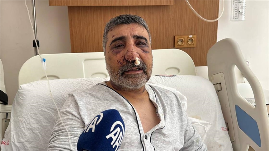 Eyüpsultan'da İngiliz boksörün darbettiği taksici Biçer, yaşadıklarını anlattı