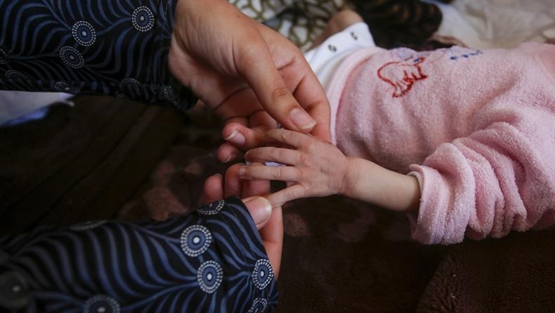 حالة صادمة بغزة.. ولادة طفلة "بلا دماغ" ومطالب بالتحقيق في أسلحة إسرائيل (تقرير إخباري)