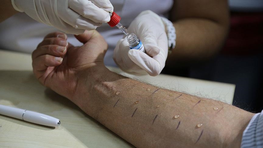 Türkiye'de toplumun yüzde 20'si alerjik belirtiler gösteriyor 