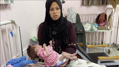 التجويع الإسرائيلي بغزة ينهش الرضيع يوسف ويحوله لـ"هيكل عظمي" 