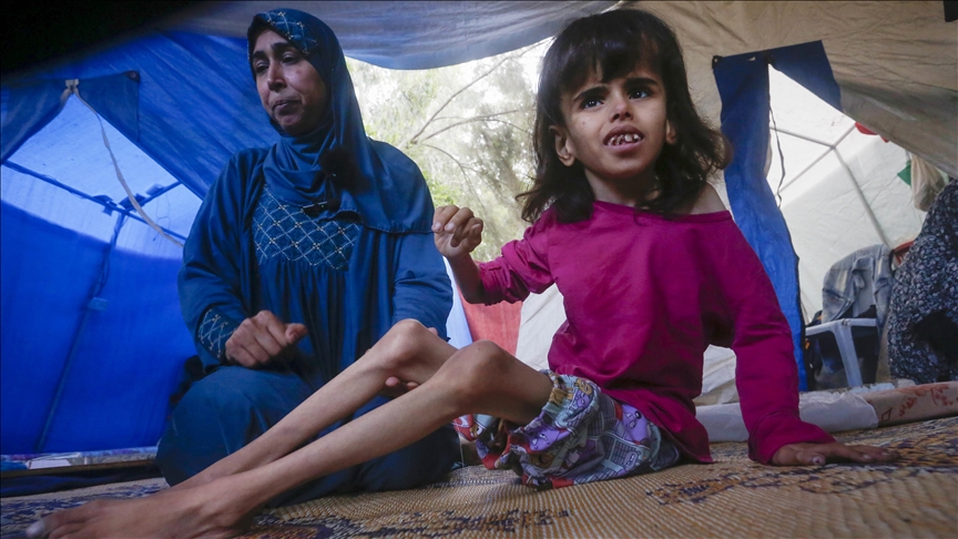 Gaza girl’s fight for life reveals a generation’s silent hunger