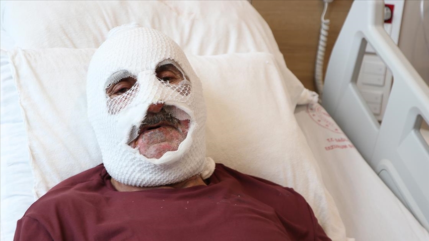 Tüpteki gaz kaçağını çakmakla kontrol edince hastanelik oldu