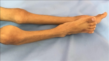 حماس: سیاست گرسنگی دادن به کودکان غزه جنایت جنگی مضاعف اسرائيل است