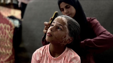 لانا.. طفلة فلسطينية شيبتها الإبادة الإسرائيلية 