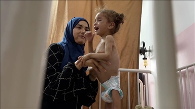 Miyar, viktima e vogël e bllokadës së Izraelit në Gaza "nuk ka më forcë të qëndrojë në këmbë"