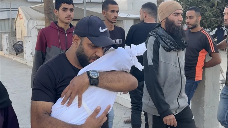 وفاة طفل في غزة بسبب سوء التغذية