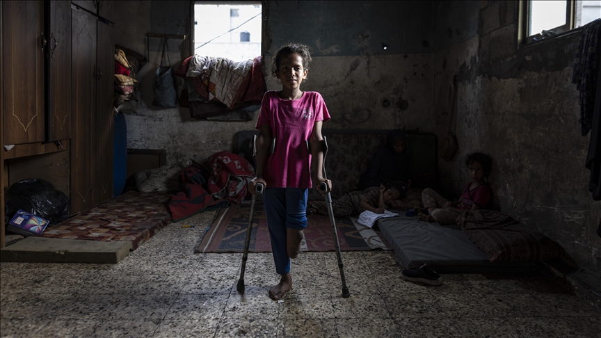Vajza palestineze që humbi këmbën në sulmin izraelit pret të ketë një këmbë protetike