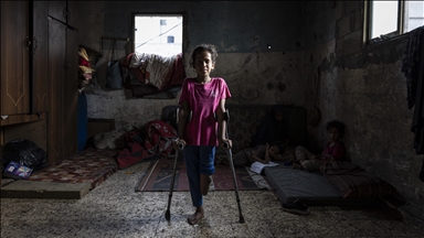 Dvanaestogodišnja Palestinka čeka protezu nakon ranjavanja u izraelskom napadu