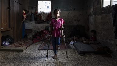 Vajza palestineze që humbi këmbën në sulmin izraelit pret të ketë një këmbë protetike