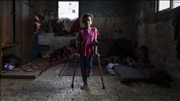 Vajza palestineze që humbi këmbën në sulmin izraelit pret të ketë një këmbë protetike