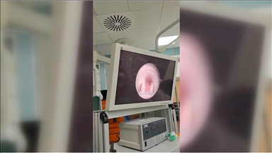 Yutkunamama şikayetiyle hastaneye götürülen çocuğun yemek borusundan et parçası çıktı