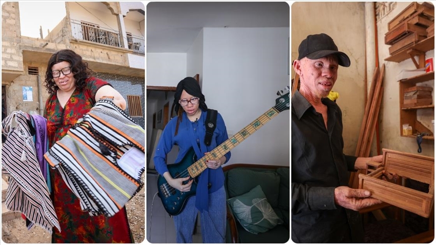 Senegalli albinolar önyargıları moda, sanat ve zanaat ile yıkıyor