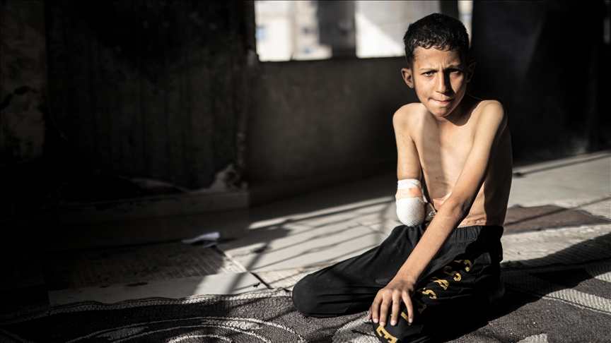 Ahmedi nga Gaza, i cili u sulmua nga Izraeli ndërsa luante futboll, dëshiron që t'i kthehet dora e tij