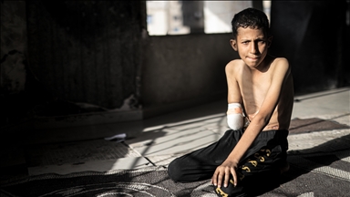 Ahmedi nga Gaza, i cili u sulmua nga Izraeli ndërsa luante futboll, dëshiron që t'i kthehet dora e tij