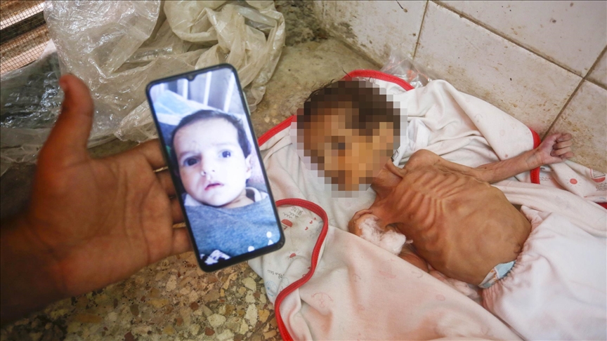الحليب مفقود والموت حاضر بغزة.. الرضيعة جوري تلحق بكندة ونضال (تقرير)