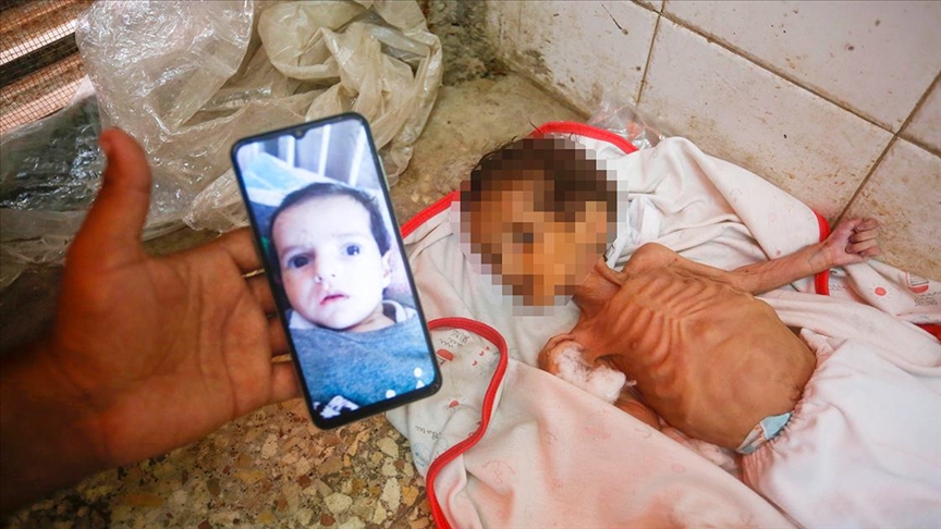 İsrail ablukası altındaki Gazze'de 3 aylık bebek Curi de açlıktan hayatını kaybetti