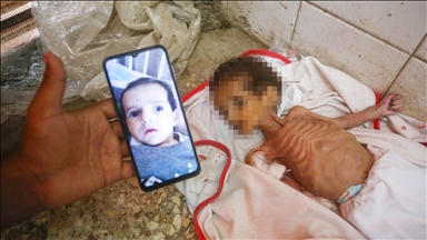 الحليب مفقود والموت حاضر بغزة.. الرضيعة جوري تلحق بكندة ونضال