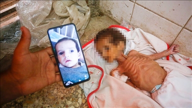 İsrail ablukası altındaki Gazze'de 3 aylık bebek Curi de açlıktan öldü