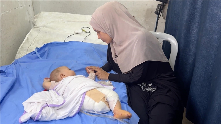 İsrail'in Gazze’ye saldırısında ayağını kaybeden 4 aylık Hani bebek, yaşam mücadelesi veriyor