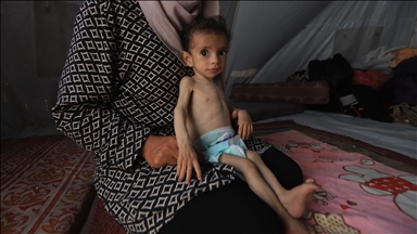 66 children die from malnutrition in Gaza under Israeli blockade since October 2023
