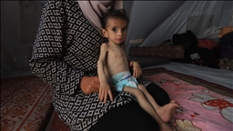 66 children die from malnutrition in Gaza under Israeli blockade since October 2023