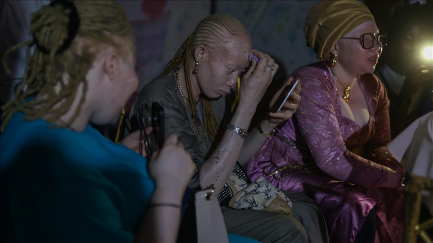 Albino osobe u Senegalu modnom revijom podižu svijest o raku kože