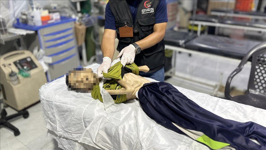 حكومة غزة: وفاة شاب بسوء التغذية منعطف خطير بمسار الكارثة 